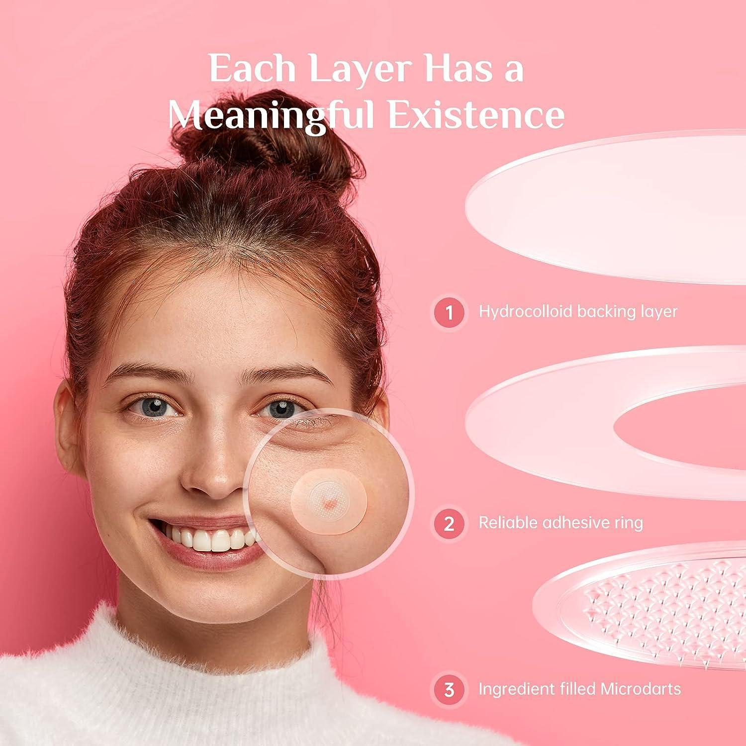 Mild And Non-irritating Desalting PIMPLE Acne Closed Mouth Acne Patch